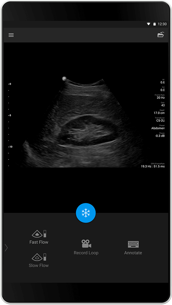 Abdomen Exam (Abdomenunders&oslash;kelse), C5-2