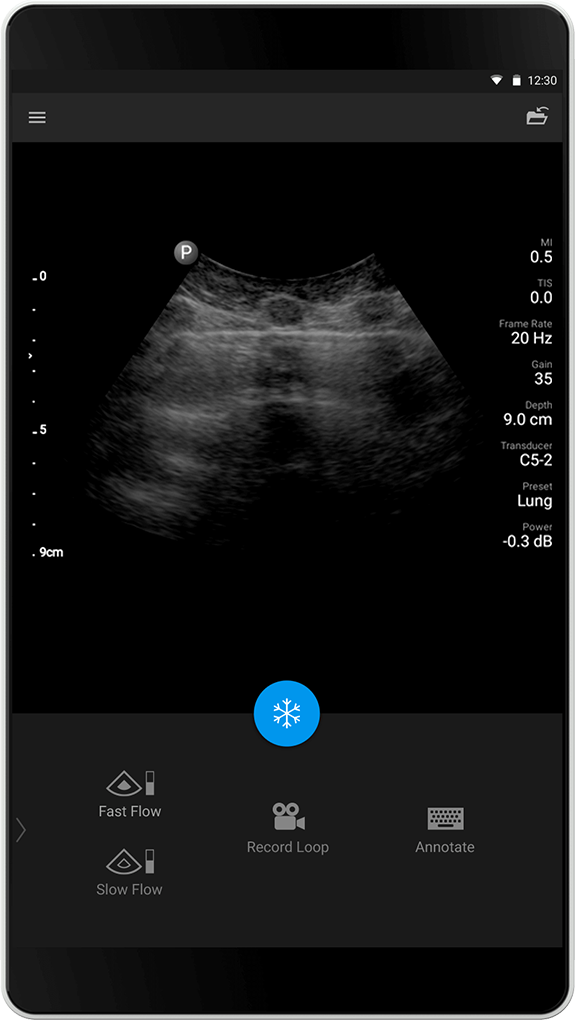 Lung exam (Lungeunders&oslash;kelse), C5-2