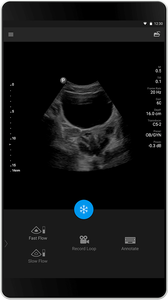 OB/GYN Exam (OB/GYN-unders&oslash;kelse), C5-2