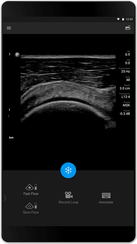 Lung Exam (Lungeunders&oslash;kelse)