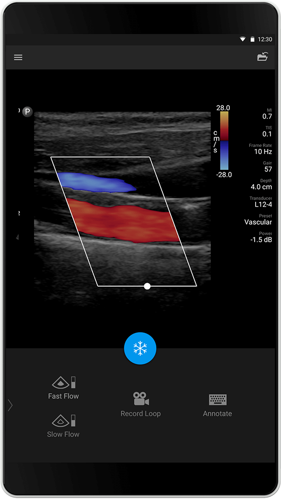 Vascular Exam (Vaskul&aelig;r unders&oslash;kelse), L12-4