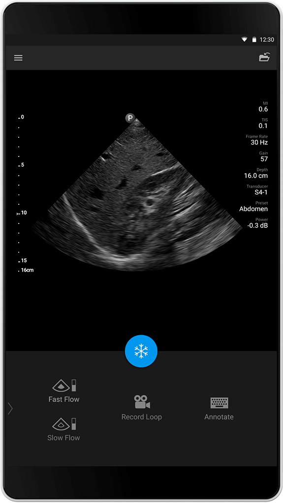 Abdomen Exam (Abdomenunders&oslash;kelse), S4-1