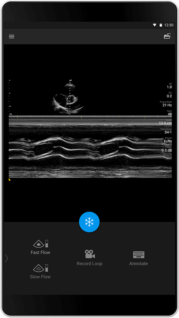 Echo Exam (Ekkounders&oslash;kelse), S4-1