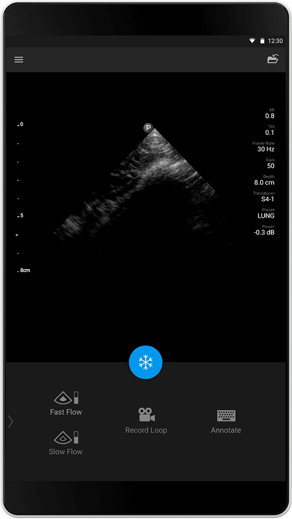 Lung exam (Lungeunders&oslash;kelse), S4-1