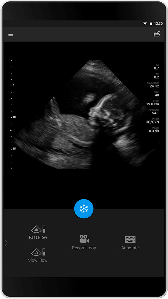 OB/GYN Exam (OB/GYN-unders&oslash;kelse), S4-1